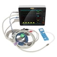 thumbnail image 1 of Monitor veterinario, presión arterial veterinaria digital Monitor veterinario digital Monitor de presión arterial veterinaria Materiales ecológicos Jadeshay A, 1 of 8