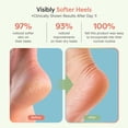 thumbnail image 5 of ZenToes Moisturizing Sleep Socks with Vitamin E, Olive Oil and Jojoba Seed Oil to Soften and Hydrate Dry Cracked Heels (Snowflakes, Regular), 5 of 9