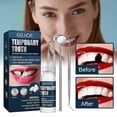 thumbnail image 4 of Falseteeth Teeth Solid Glue Temporary Filling Set For Repairing Missing And Broken Teeth Fake Tooth Dentures, 4 of 5