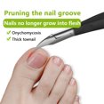 thumbnail image 2 of Nail Clippers Portable Professional Washable Anti-corrosive Nonslip Replacement Toenail Ingrown Trimmer Pedicure Caring Tool Black 1Pc, 2 of 8