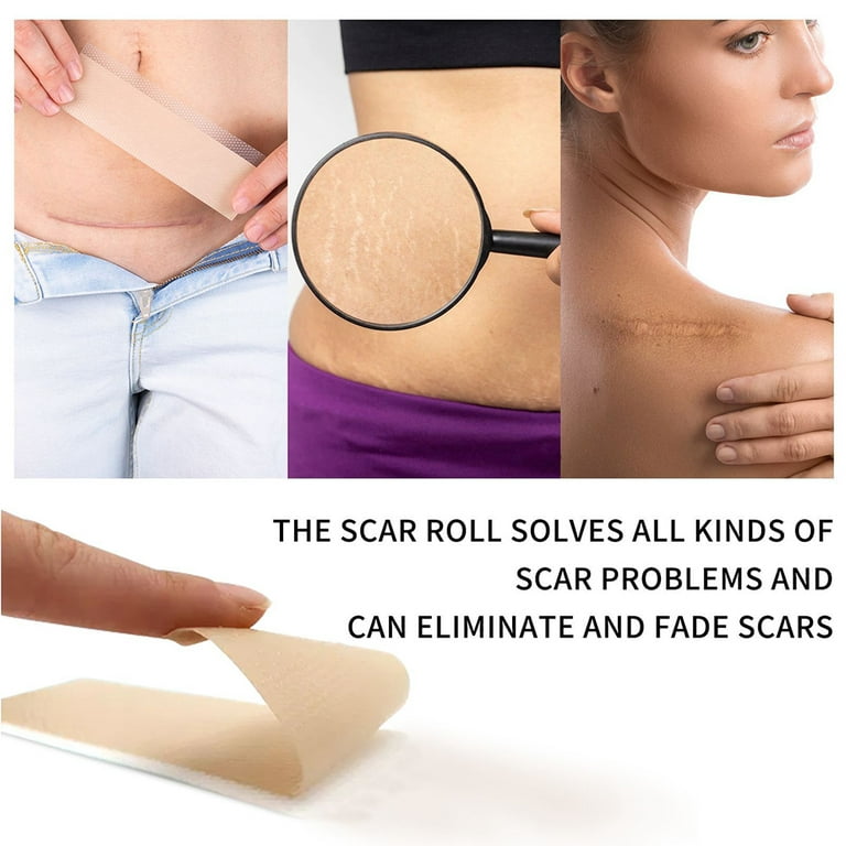 Scar Removal Silicone Tape for Scars & Keloids,1 Roll, 1.6'' x 60''/1.6”x  120”