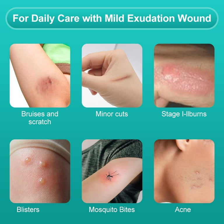 hydrocolloid dressing for cuts Amazon.com: Healqu Hydrocolloid Wound Dressing - 4x4 Thin - Box of 10 Large Bandages - Sterilized Bordered Hydrocolloid Patches for Bed Sores, Abrasions, and More