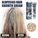 thumbnail image 4 of 1-3X New Alopecia Treatment Cream Hair Growing Prevent Alopecia Baldness Regrowth 20g, 4 of 4