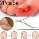 thumbnail image 2 of Juego de pinzas correctoras de uñas encarnadas, 2 of 3
