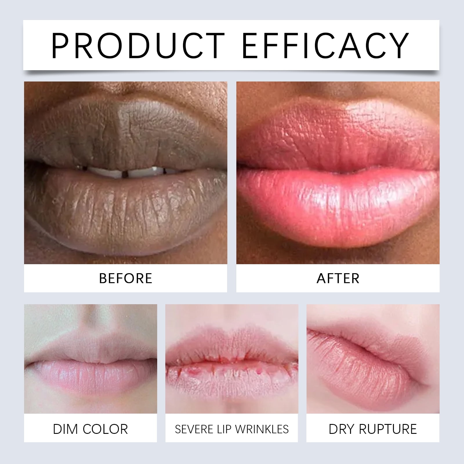 Alvantor Lip Balm Moisturizing Brightening Stick with Beeswax Niacinamide SPF Lip Care for Dry Chapped Lips Long Lasting Hydration, 0.25oz