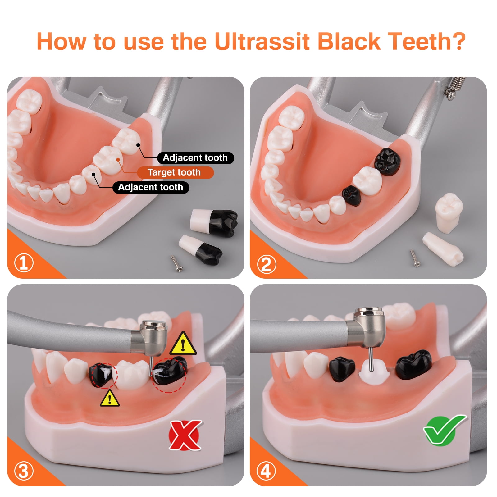 Typodont Teeth Model Includes 20pcs of Special Black Replacement Teeth