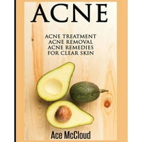 Acne Skin Care Treatments from Diet & Acne: Acne Treatment: Acne Removal: Acne Remedies For Clear Skin, (Paperback)
