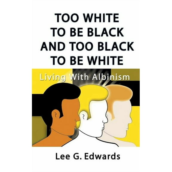 Too White to Be Black and Too Black to Be White: Living with Albinism, (Hardcover)