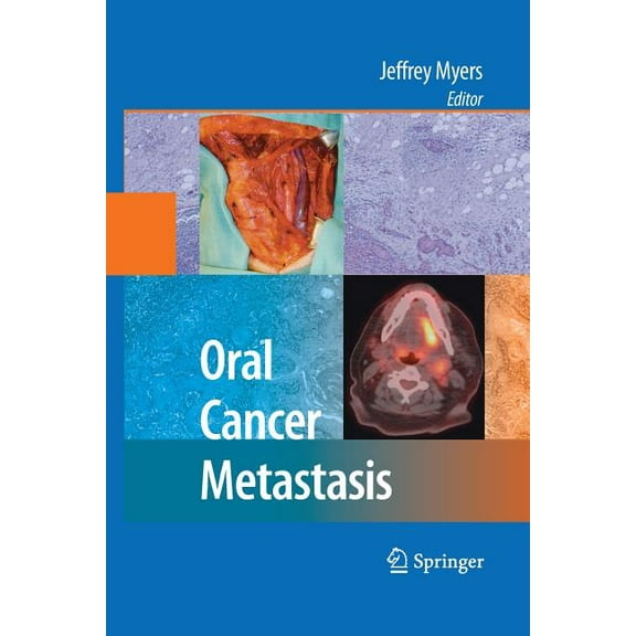 Oral Cancer Metastasis, (Paperback)