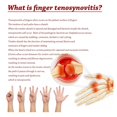 thumbnail image 3 of Parches para vainas de tendones para terapia de tenosinovitis, artritis, muñeca, pulgar y dedos, 3 of 5