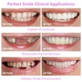 thumbnail image 5 of Aparatos de imitación para sonreír y blanquear dientes oso de fresa sexta generación, 5 of 5