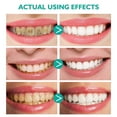 thumbnail image 3 of Aliver  Teeth Whitening Foam Toothpaste, Natural Ingredients with Citrus & Mint Essence, Gently Mousse Foaming Toothpaste and Mouthwash for Dental Care 2.11 fl.oz - 2 Pack, 3 of 9