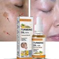 thumbnail image 1 of 3pcs Aceite de limón y cúrcuma, brillo de la piel para aclarar el acné, parches oscuros, acné, piel brillante, Corrector de manchas oscuras, blanqueamiento facial, 1 of 5
