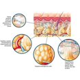 thumbnail image 4 of Instant Itching Stopper & DETOX Weight Loss Slimming Repair Tender Natural, 4 of 7