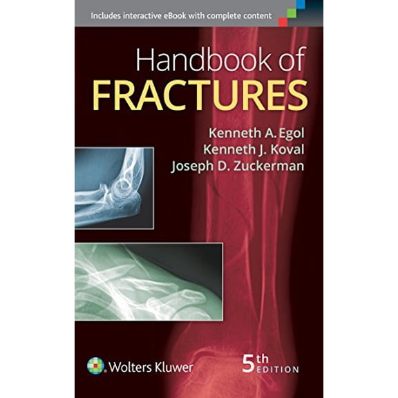 Pre-Owned Handbook of Fractures (Paperback) 1451193629 9781451193626