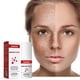 thumbnail image 1 of Hot6sl Ofertas de La Semana Acetato Semilla Perece Manchas Oscuras En Combate, Imperfecciones En La Piel, Poros Dilatados, Manchas Oscuras E Imperfecciones 30 Ml., 1 of 7