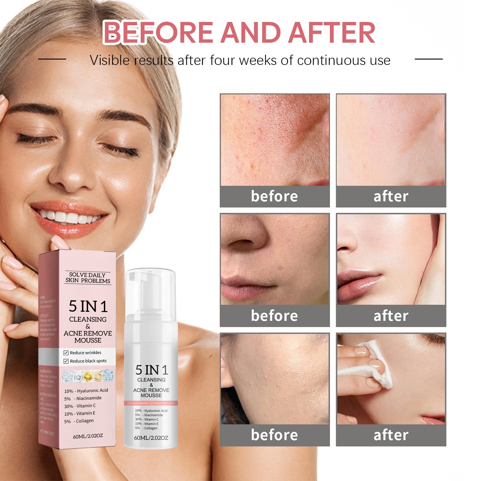 Ordinary Toner for Face Amazing Cosmetics Volcanic Ash Beard And Face Wash Makeup Removing Face Wash Brush Face Wash Dark Mark Remover for Face ning Face Wash for Dogs Beard Scrub Face Wash