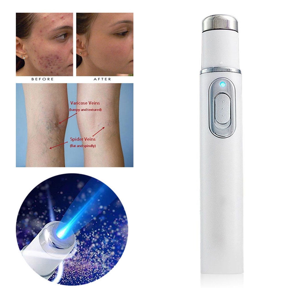 Portable Therapy Blue Light Wrinkle Removal Scar r Acne Pen KD-7910