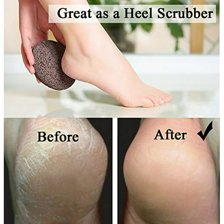 The best pumice stone for feet