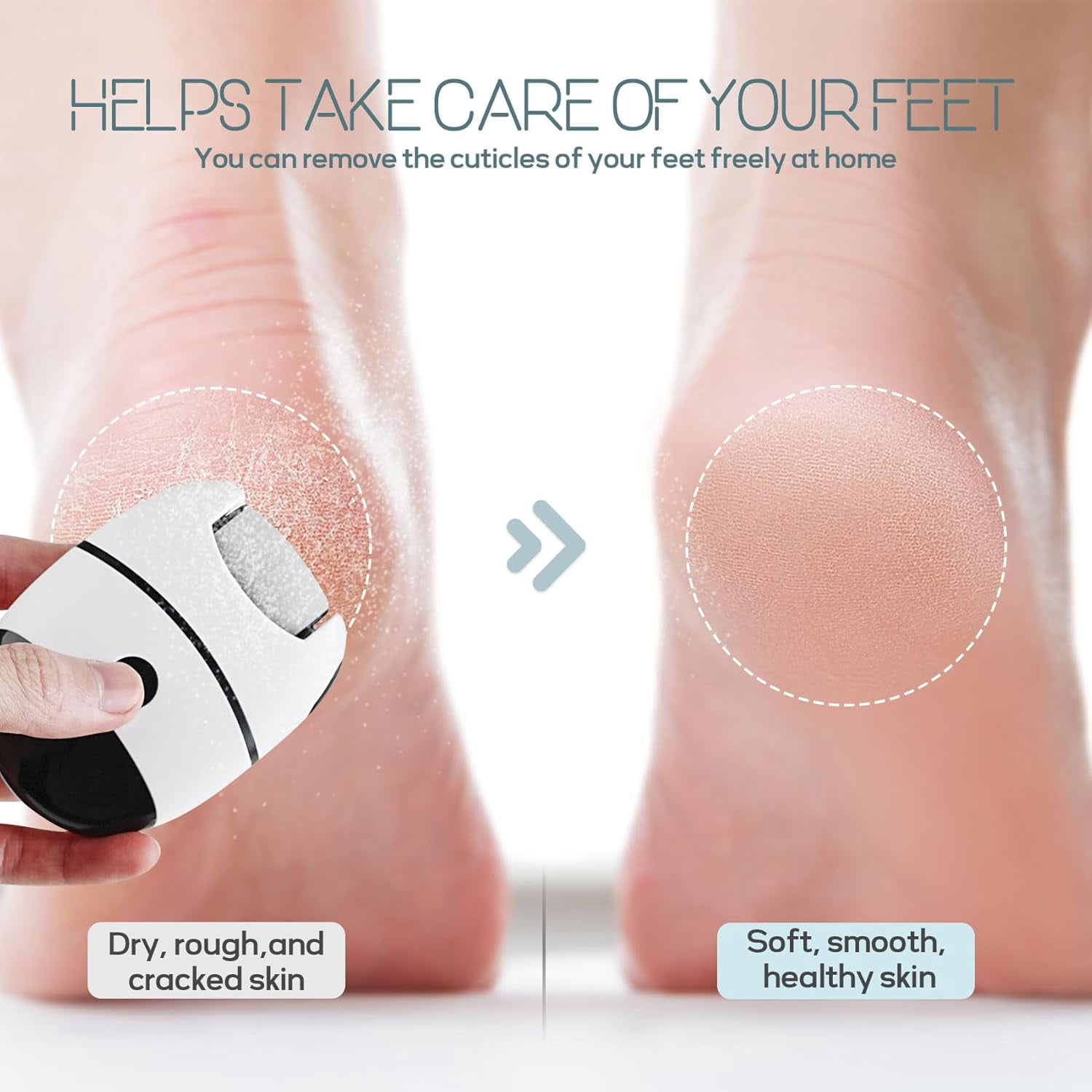 Portable Electric Callus Remover For Feet 2 Speed With 3 Rollers Foot File Dead Skin Exfoliator Pedicure Care Tool