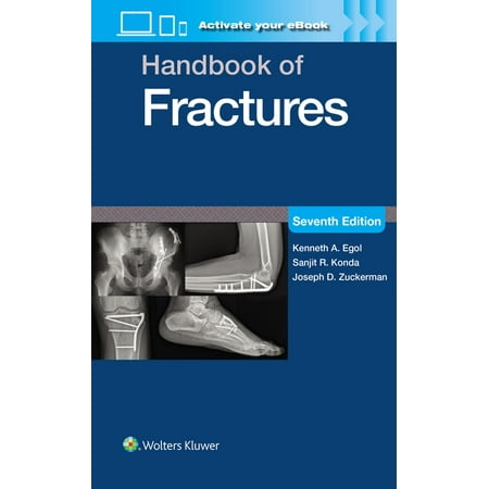 Handbook of Fractures: Print + eBook with Multimedia (Paperback)