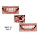 thumbnail image 3 of High Quality Dentures Instant Smile Comfort Fit Flexible Cosmetic Teeth Dentures Teeth, 3 of 4