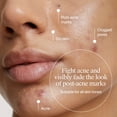 thumbnail image 4 of Neutrogena Evenly Clear Acne Gel Moisturizer, 1.7 fl. oz, 4 of 17
