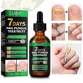 thumbnail image 3 of Nail Fungus Treatment, Ginger Nail Fungus Treatment, 7 Days Nail Fungus Treatment for Toenail, 3 of 5