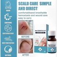 thumbnail image 5 of Clear Waterproof Liquid Bandage for Surface Protection and Fast Healing Support, 5 of 5