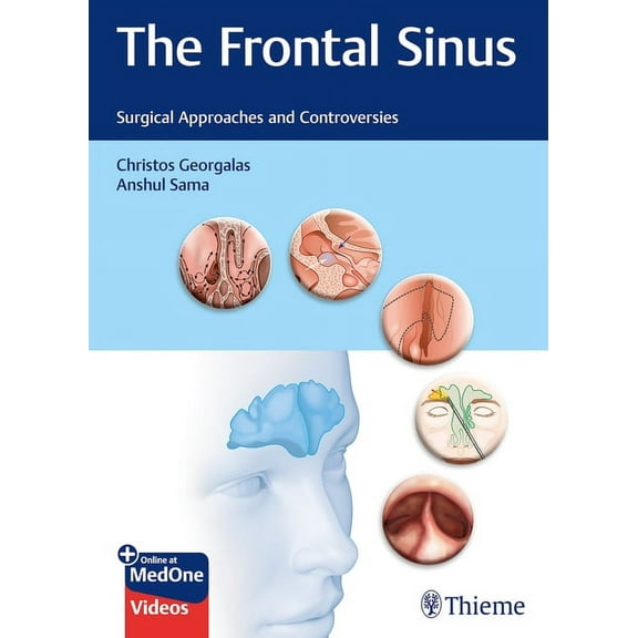 The Frontal Sinus: Surgical Approaches and Controversies, (Hardcover)