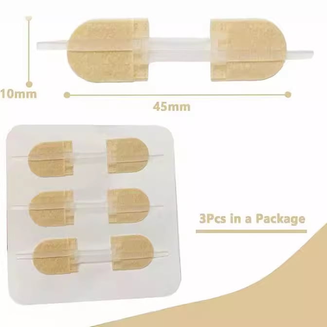 thumbnail image 2 of Zip Stitch Sutures Butterfly Bandaids Eergency Zipstitch Wound Closure Device 1924912601 2 of 9