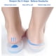 thumbnail image 5 of 3 pares de talones de gel para fascitis plantar, almohadillas de gel de silicona para el dolor de talón, espolón óseo y dolor de Aquiles, cojines y copas de gel para el talón, 5 of 5