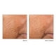 thumbnail image 3 of Cápsulas de sérum nocturno RoC Retinol Correxion Line Suavizan, 3 of 8