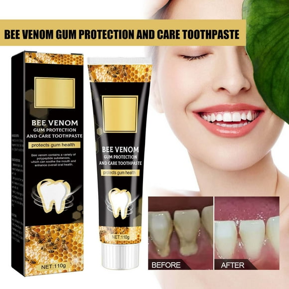 Pasta de dientes, Pasta de dientes blanqueadora, Pasta de dientes Bee Care Limpieza de manchas de sarro Olor a sarro Aliento fresco Pasta de dientes blanqueadora 110 g Cepillos de dientes y cremas