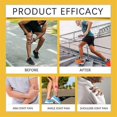 thumbnail image 5 of 1-5x Bone & Joint Gel, Bee Venom Cream, New Zealand Bee Venom Professional Gel, Joint Cream of Neck, Knee, Shoulder, Waist, Legs, 5 of 5