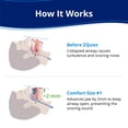 thumbnail image 2 of ZQuiet, Anti-Snoring Mouthpiece, Comfort Size #1, Single Refill, Blue, Made in USA, BPA-Free, Medical-Grade Material, 2 of 6