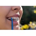 thumbnail image 3 of Aligner Removal Tool For Invisalign, Braces And Retainers | Clear Aligner Remover (blue), 3 of 4