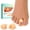 Beige, variant on Welnove Hammer Toe Corrector - 6 Pack Soft Gel Toe Splints & Straighteners to Realign Bent, Curled, Crooked, Claw & Hammer Toes, Men & Women, Large, Beige