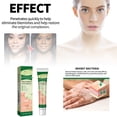 thumbnail image 1 of Skin Hand Skin Skin Gentle Moisturizing Skin Topical Care ！, 1 of 8