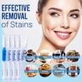 thumbnail image 4 of Kit de bolígrafo y gel blanqueador de dientes VieBeauti con peróxido de carbamida al 35%, 4 of 9