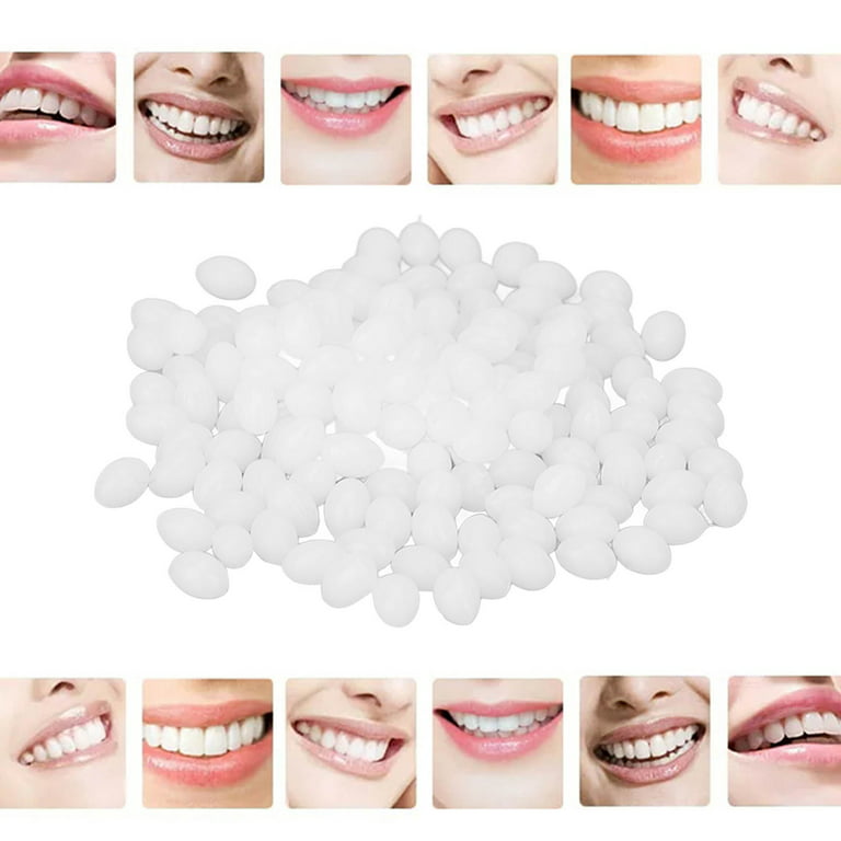 Teeth Adhesive Fitting Beads, Tooth Repair Beads Temporary, Dental Filling Fixing Beads for Broken Missing Teeth White 50g