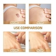 thumbnail image 4 of WIFKLSIIPG Skin Invisibles Concealer Sticker Tattoo Concealer Sticker Ultra Thin Patch Skin Tone Sticker Scar Tattoo Acne Seal Covering Sticker Waterproof, 4 of 7