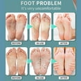 thumbnail image 4 of Foot Treatment Spray, Mild Moisturize Peeling Foot Treatment Spray  For Foot, 4 of 8