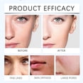 thumbnail image 5 of 3% Hydrating Vials Hydrating Use Vials Tubes 3% Vials Suitable For All Types 36ml, 5 of 5