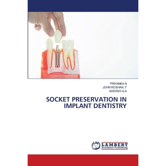 Socket Preservation in Implant Dentistry, (Paperback)