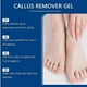 thumbnail image 4 of Callus Remover for Feet, Extra Strength Foot Callus Remover Gel, Dead Skin Removal for Feet, Dry Cracked Heel Repair, Peel Exfoliator Foot Care, 4 of 5