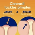 thumbnail image 4 of Clearasil Stubborn Acne Control 5 In1 Daily Cleansing Face Pads, 90 Ea, 3 Pack, 4 of 6