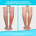 thumbnail image 3 of 2 Pairs Open Toe Copper Compression Socks for Women & Men Circulation 15-20 mmhg - Better Blood Flow, Swelling, Best Support for Medical, Running, Nursing, 3 of 7