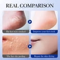 thumbnail image 7 of Summer Non-Cracking Vaselines Shea Repair Stick Hydrating Moisturising Long Lasting Protection, 7 of 7