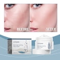thumbnail image 1 of Fiudx Ofertas Y Liquidación La Crema Eliminadora De Manchas Repone La Humedad, Reafirma La Piel, Ilumina El Cutis Y Elimina Las Manchas., 1 of 6